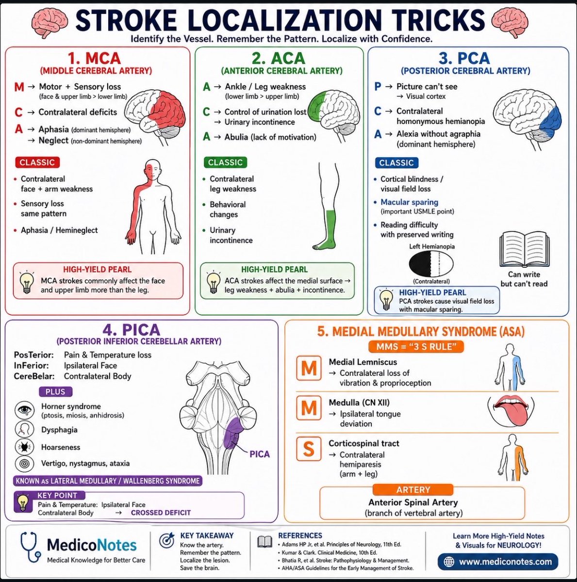 world_of_med1's tweet photo. Stroke 🧠 https://t.co/HLAbdusxVB