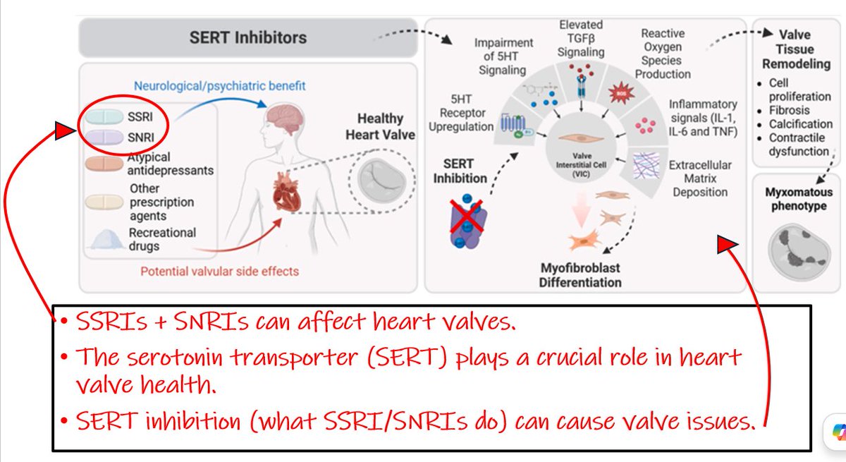 AdamUrato1's tweet photo. Does Serotonin play a vital role in heart valve health?
-Yes.

This NEW STUDY shows that drugs that affect the serotonin transporter (like SSRI/SNRIs) are associated with ⬆️ heart valve disease risk.

The paper itself is an outstanding serotonin review. https://t.co/foi8ciuXLD https://t.co/cMOrqT54R6