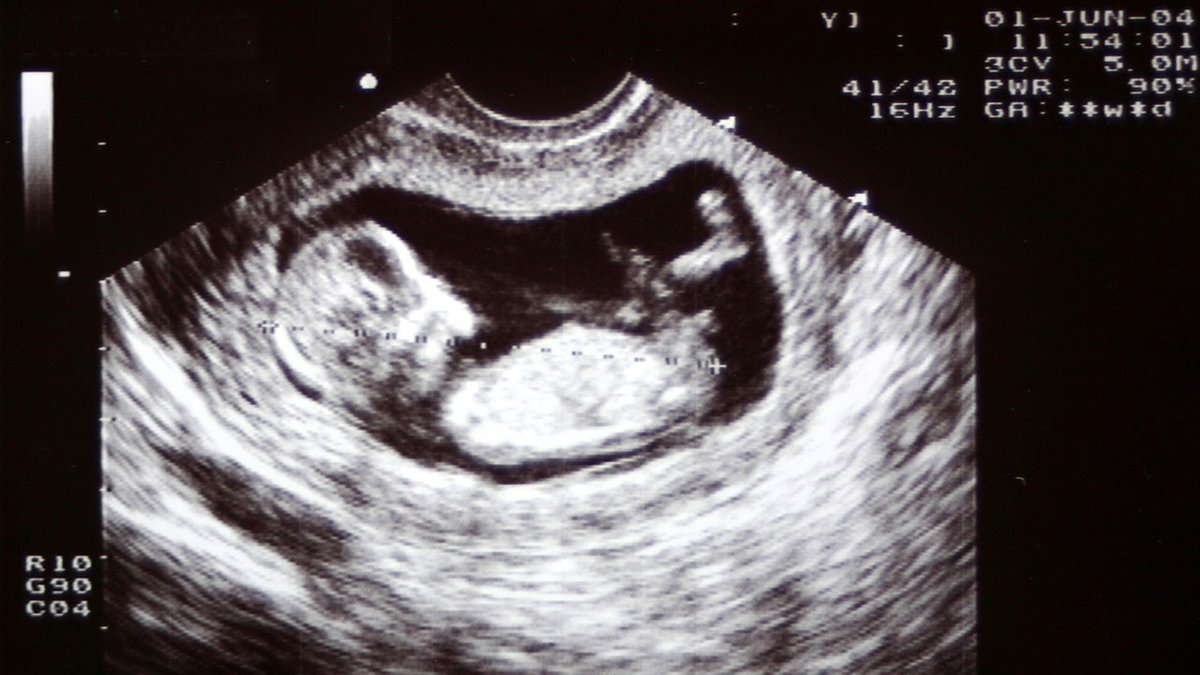 Sskyup666's tweet photo. GUYS ITS CONFIRMED ITS A BABY BOY AND HE IS JUST LIKE HIS PAPA FR #ihatemylife #goingoutforthemilk #nochildsupport #ididntknowholdinghandswoulddothis #genderreveal😀 https://t.co/hYlZmnjjEN