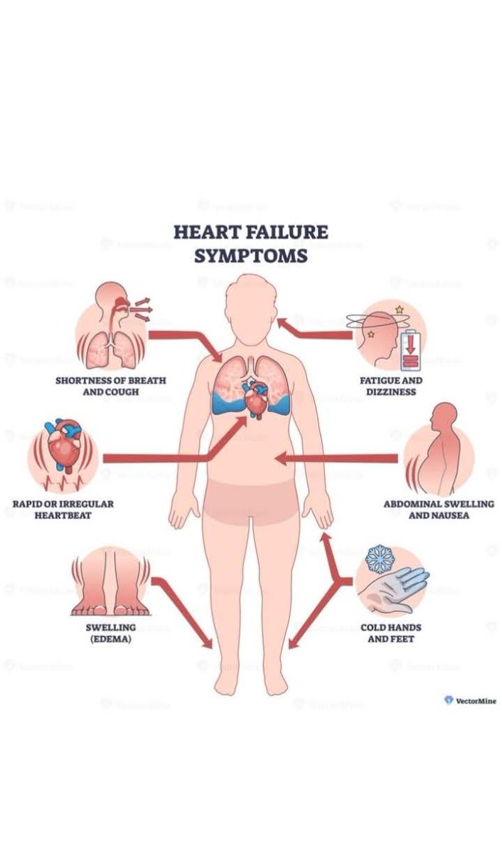 stevejacks's tweet photo. Over five years now.  According to Dr google I should be dead. But by power of modern medicine and inbuilt pacemaker and defibrillator I'm still here.  I plan to stay! https://t.co/3p5k2xeivv