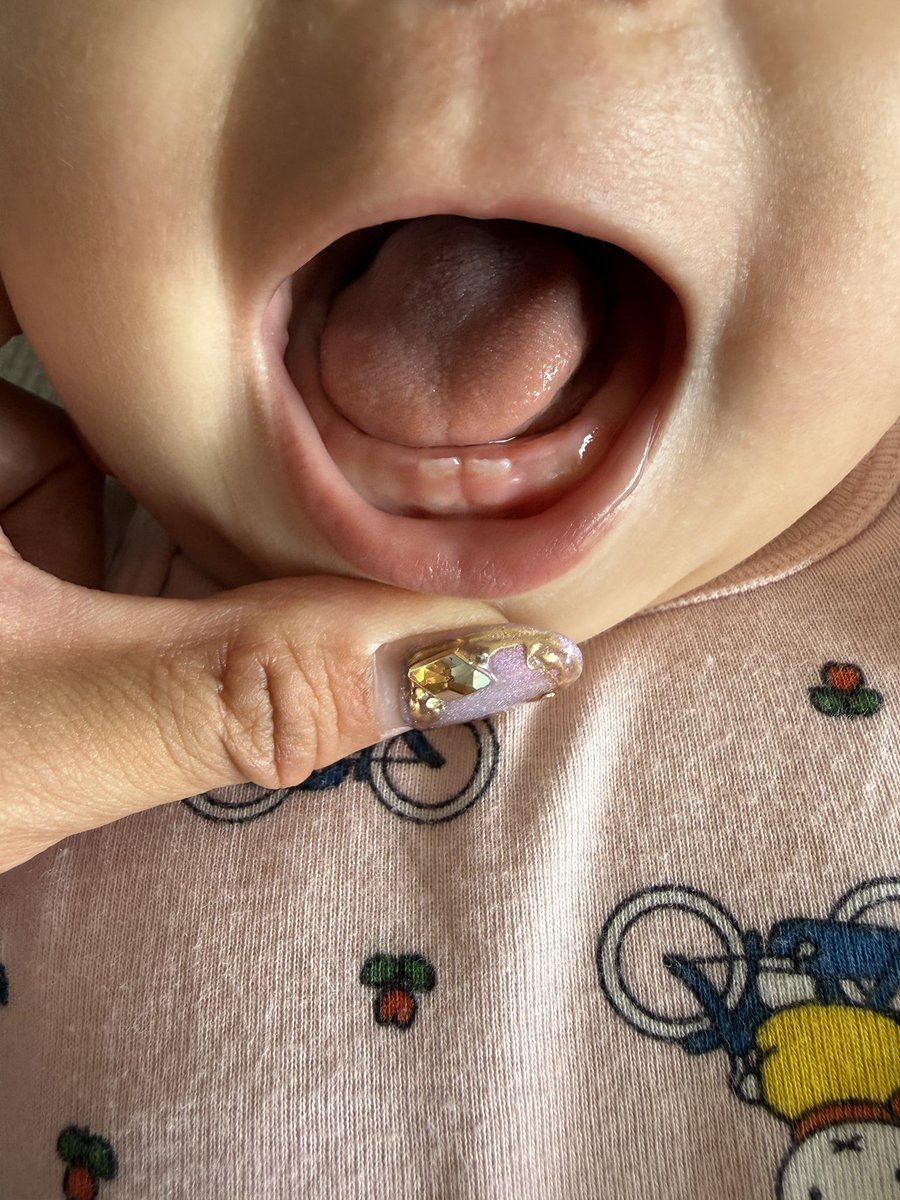 premamyu's tweet photo. ついに、こんにち歯🦷！だから最近、ブーって唾飛ばしてばっかだったのか🤣
#5ヶ月 https://t.co/cOgchPLJyv