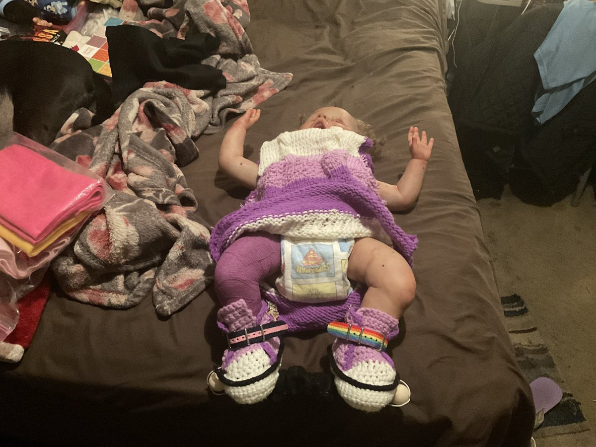 AngelicScroll95's tweet photo. Great News: Brönte’s Club Foot Brace has been fully completed and assembled! I might need to add some Velcro attachments somewhere, but overall? I’m extremely proud! #reborn #reborns #clubfoot https://t.co/9VuGj8aYzT