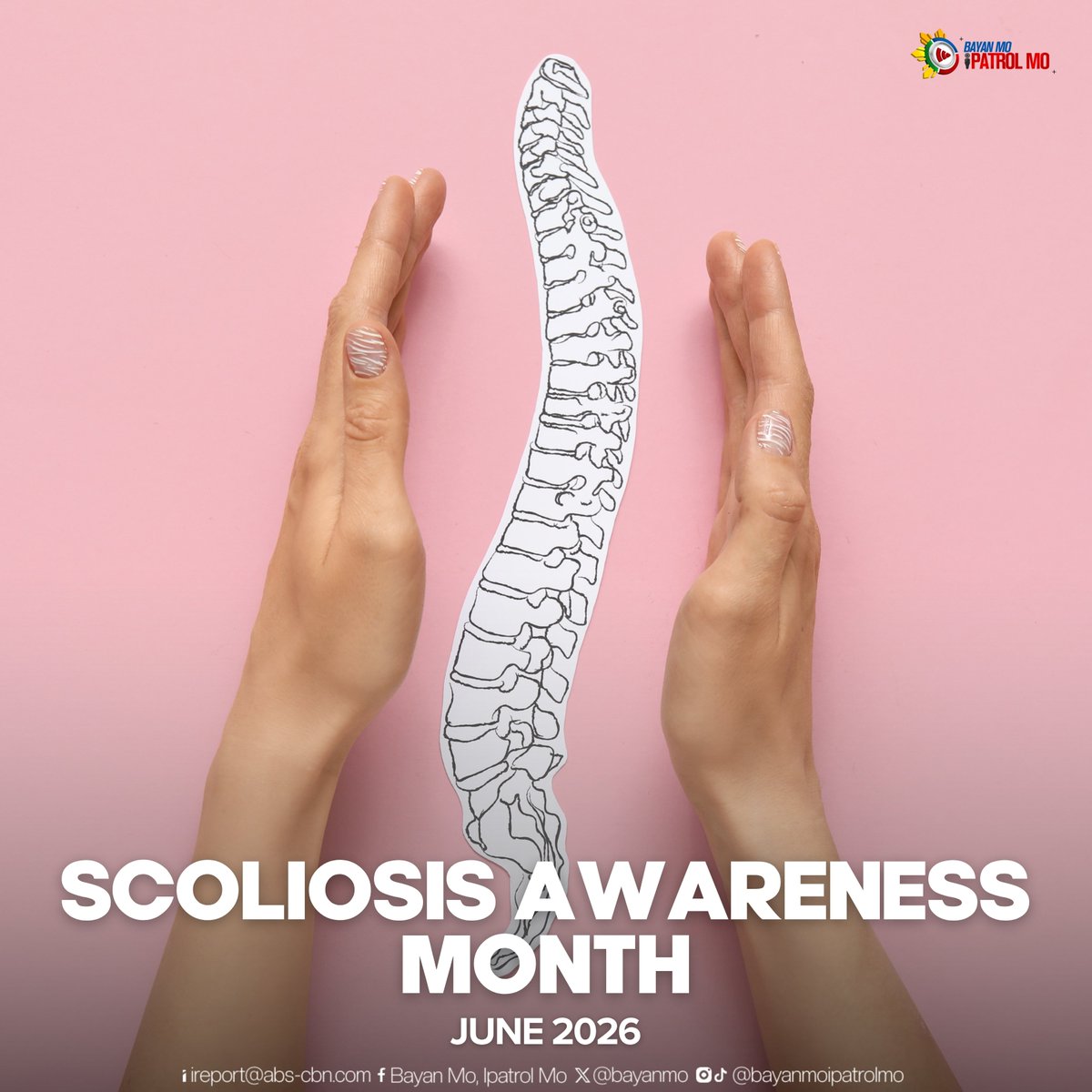 bayanmo's tweet photo. EARLY DETECTION IS KEY 🏥🩻

Layunin ng Scoliosis Awareness Month na palawakin ang kamalayan tungkol sa scoliosis at hikayatin ang maagang pagsusuri upang maiwasan ang paglala ng kondisyon.

#BMPM https://t.co/BGV69MPr7J