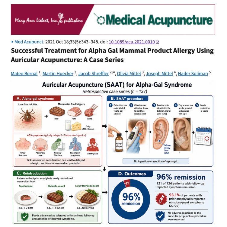 ValerieAnne1970's tweet photo. BREAKTHROUGH: 96% REMISSION for Alpha-Gal Syndrome with ONE simple Acupuncture Treatment!

While the exploding tick meat allergy now hits nearly 500,000 Americans…

A 2021 peer-reviewed study already found 96% of 137 patients went into full remission after Soliman Auricular Allergy Treatment (SAAT). 

No pills. No shots. No avoidance hell.  
Patients literally touch an allergen vial → tiny needle placed in the ear for ~3 weeks → most can eat beef, pork, dairy again without reaction (even former anaphylaxis cases: 93%+ symptom-free). Zero adverse effects.

Why are we still waiting on “cures” when this low-cost, low-risk option is putting people’s lives back together RIGHT NOW?

This is criminal to keep quiet. Share if you or anyone you know has Alpha-Gal — they need to see this TODAY.