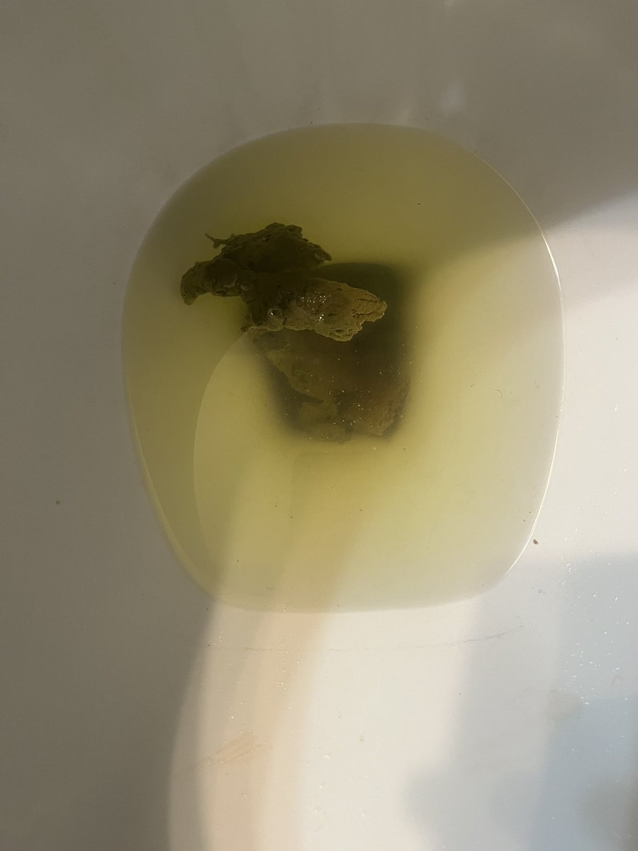 atlscatguy's tweet photo. Today’s dump https://t.co/QQKqkzrPNR