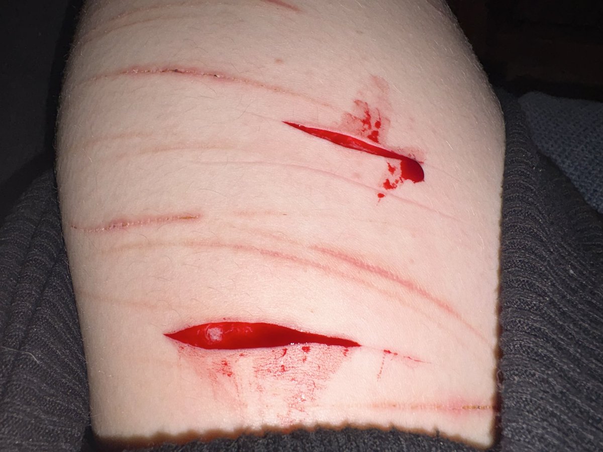 applecider3012's tweet photo. beans yayyyyy 
drunk again, don’t enjoy cutting while sober
love yall
#drunktwt
#edtwt
#cutspo https://t.co/54QL62ZQao