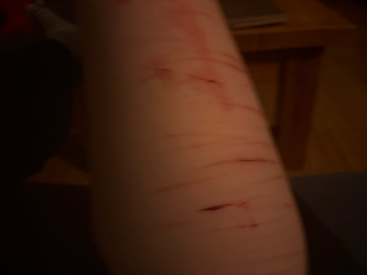 applecider3012's tweet photo. beans yayyyyy 
drunk again, don’t enjoy cutting while sober
love yall
#drunktwt
#edtwt
#cutspo https://t.co/54QL62ZQao