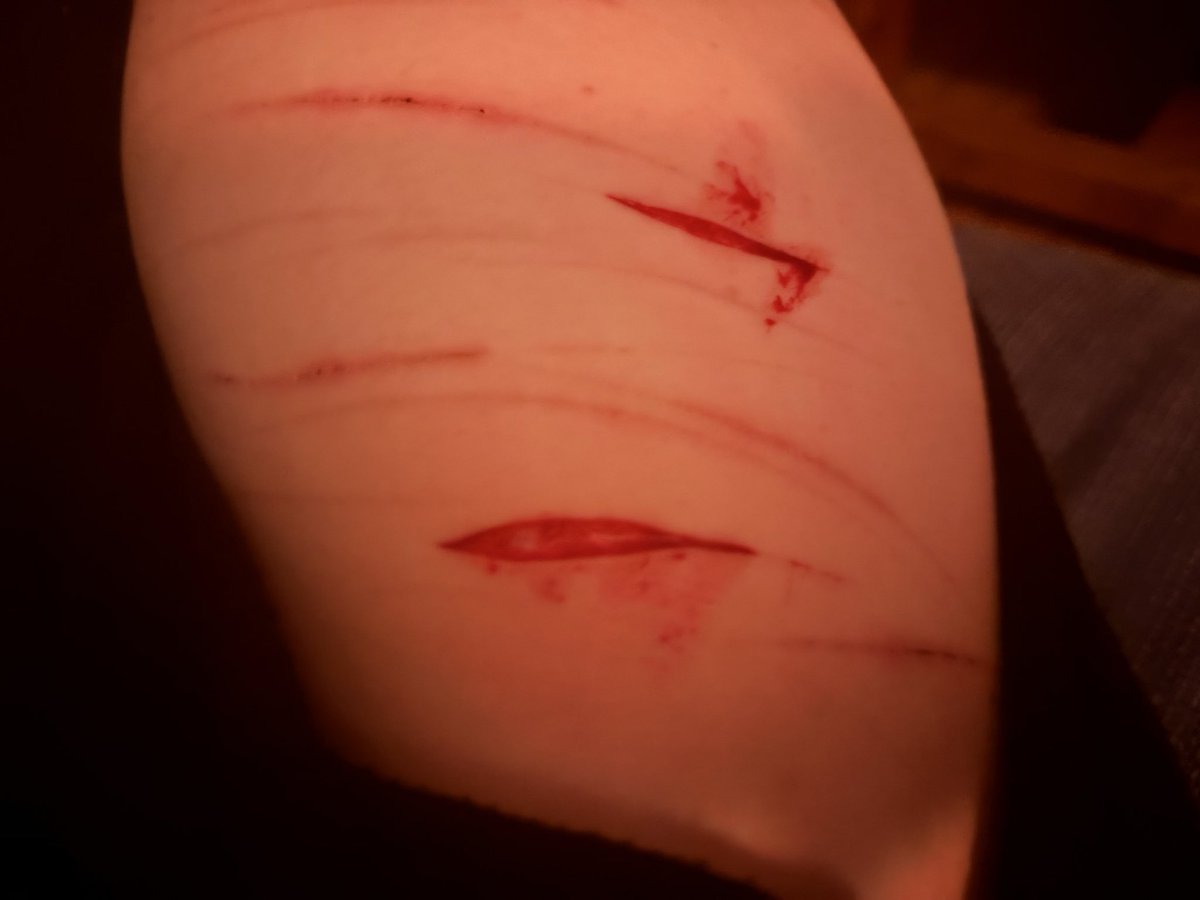 applecider3012's tweet photo. beans yayyyyy 
drunk again, don’t enjoy cutting while sober
love yall
#drunktwt
#edtwt
#cutspo https://t.co/54QL62ZQao