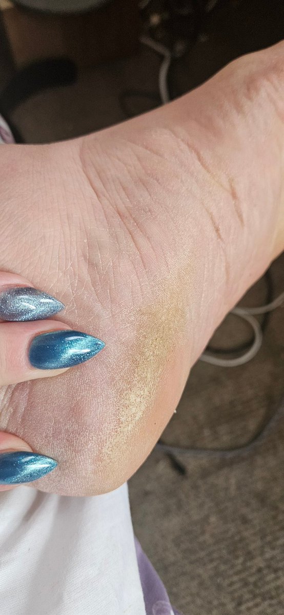 kentshornybbw's tweet photo. Hope you've been enjoying the heat!! #footfetısh #drysoles #maturefeet #bbwescort #dustyheels #footworship #wrinkledsoles https://t.co/mCewhWQzpa