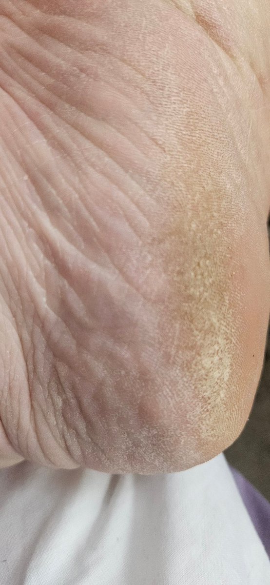 kentshornybbw's tweet photo. Hope you've been enjoying the heat!! #footfetısh #drysoles #maturefeet #bbwescort #dustyheels #footworship #wrinkledsoles https://t.co/mCewhWQzpa