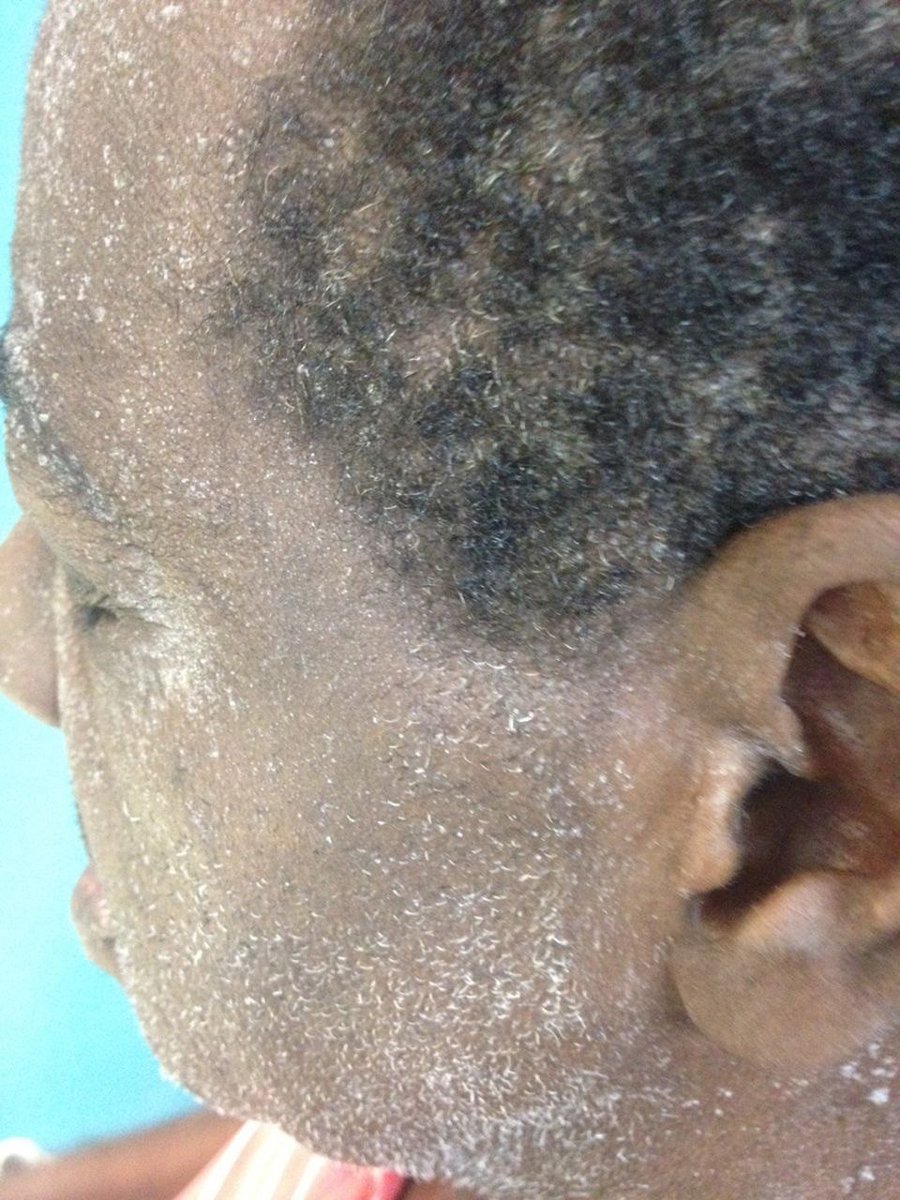 IhabFathiSulima's tweet photo. What organ Failure? https://t.co/i4Nr29CQf4
