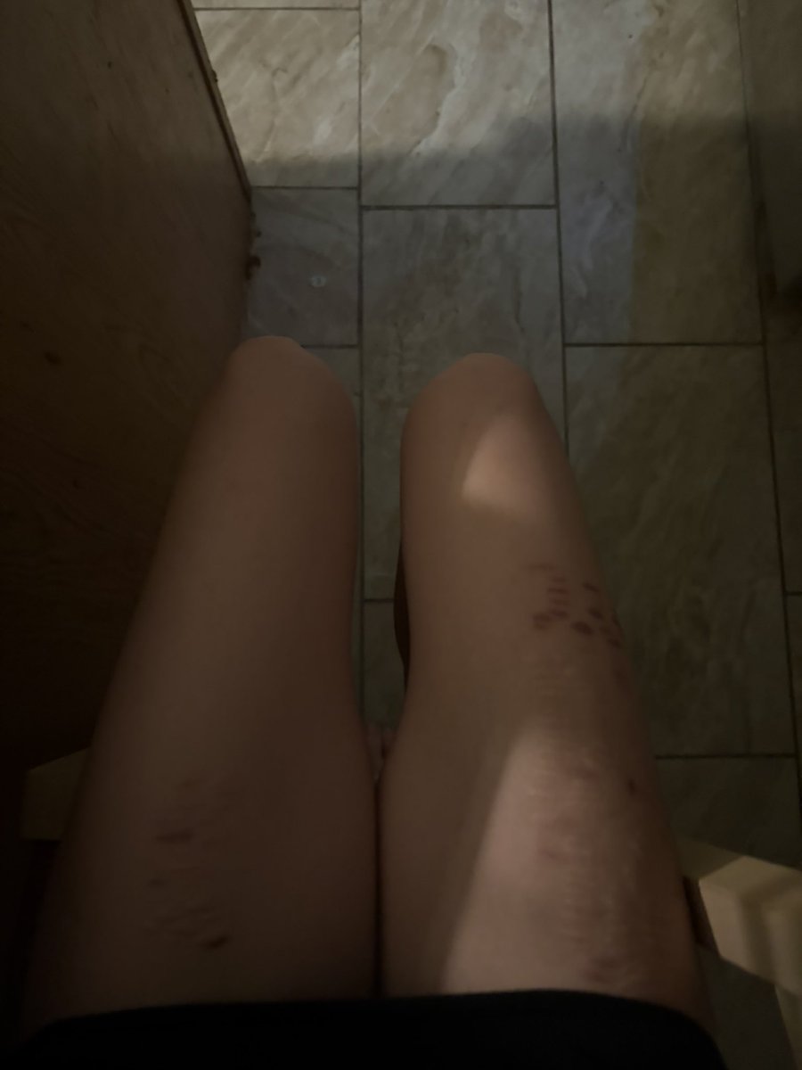 lightscigg's tweet photo. im so huge https://t.co/OPOlmu7eOR