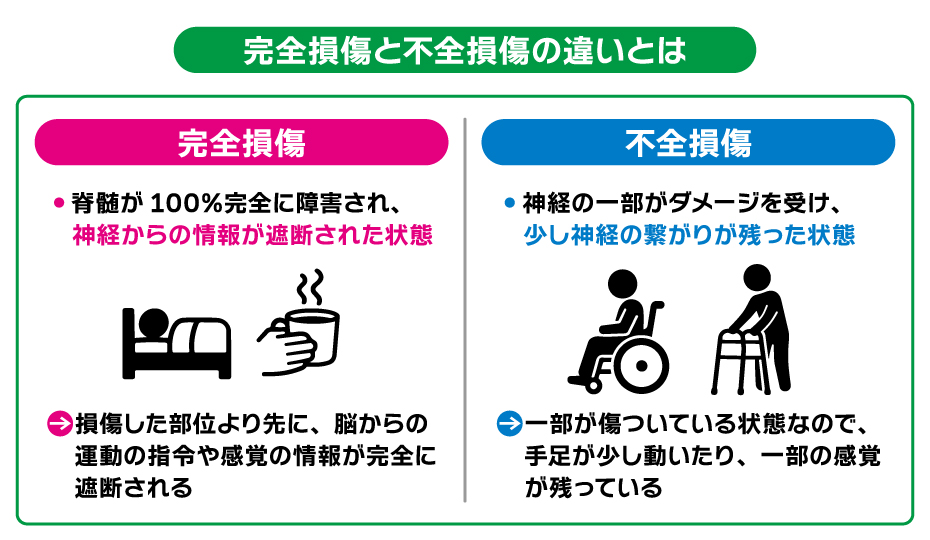 _neurotech's tweet photo. 【 #脊髄損傷 の完全麻痺と不全麻痺の違い】

回復の可能性やリハビリの方向性は
”損傷の度合い”によって左右されます🧑‍⚕️

#再生医療 でも、一部機能が残存している
不全麻痺の方が変化が現れやすい傾向に🌱
ただ、完全麻痺の方でも
感覚が分かるようになった等の変化が
現れたケースもあります😌 https://t.co/o9TzrpMjBY