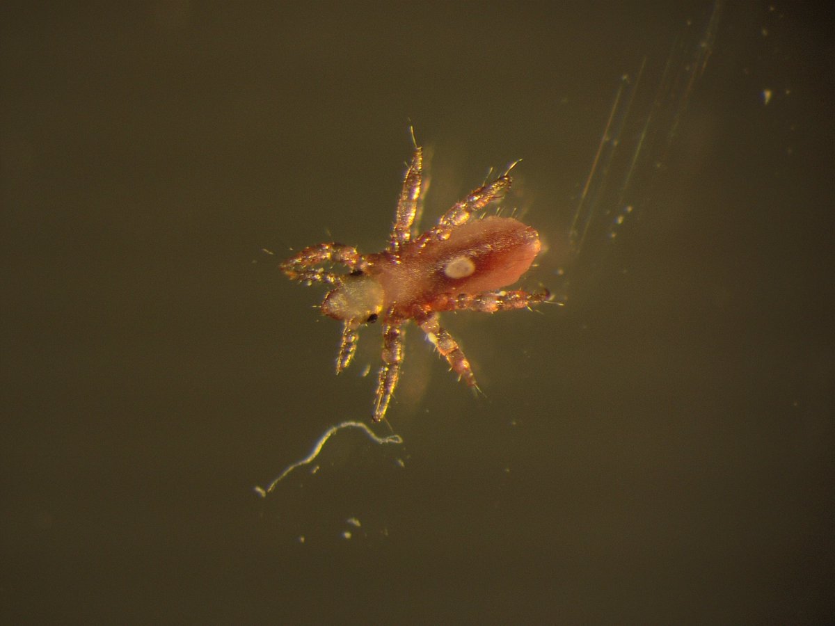 ParasiteGal's tweet photo. Answer to #Parasite Case 810 is up: "cute" little nymphal Pediculus humanus (lice). As many baby animals, their eyes appear large, giving them an endearing appearance—although your opinion may vary! 😄
https://t.co/EuYWYKtvOQ
#mayopath #pathology #PathBugs #parasitology https://t.co/cb1URa6bFC