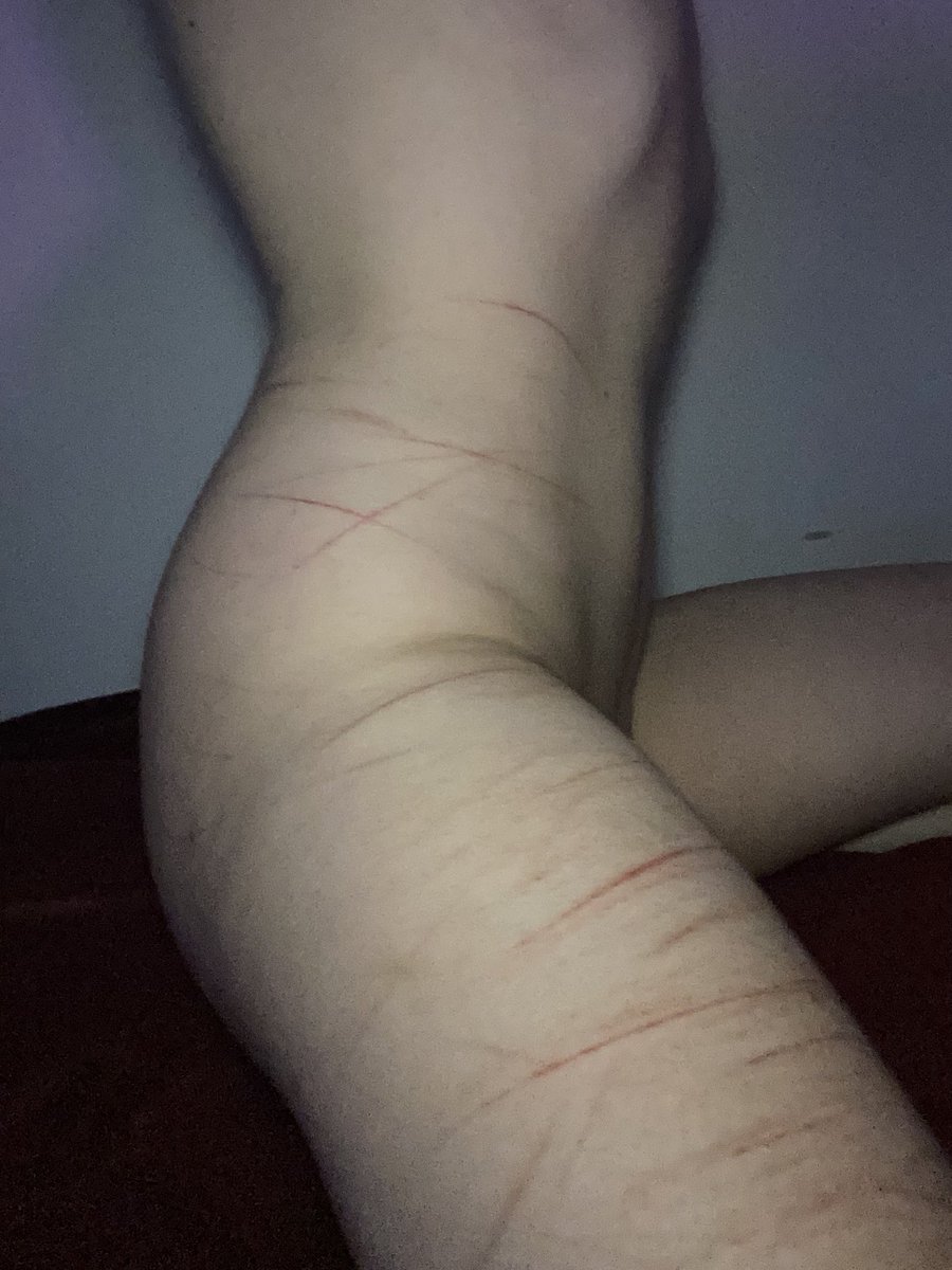 blade352337's tweet photo. my ribs are so clean
probably not for long with the lack of space i have left

#scars #sh #shtwt #slitwt #slittwt https://t.co/I3yZbcWZ0v