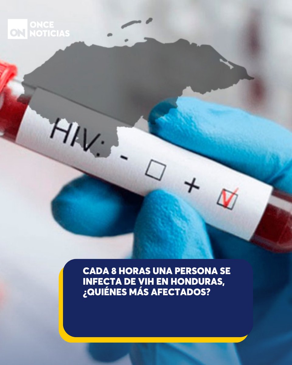 11_Noticias's tweet photo. 🔴 Autoridades sanitarias advierten que muchas personas descubren que viven con VIH de forma tardía. Cortés y Francisco Morazán encabezan las cifras. 👉 https://t.co/xy2sgKCtJl
#VIH #Honduras #Contagios https://t.co/AmxR9uWjZt