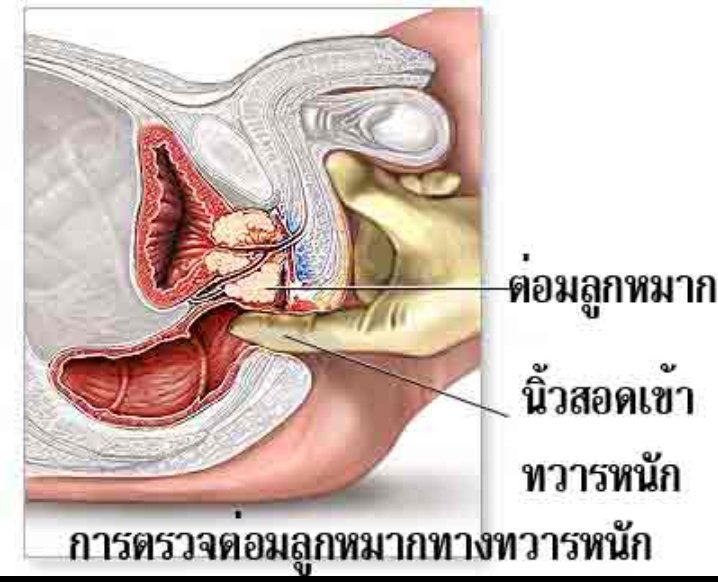 นวดนอกสถานที่ by มะนาว tweet media