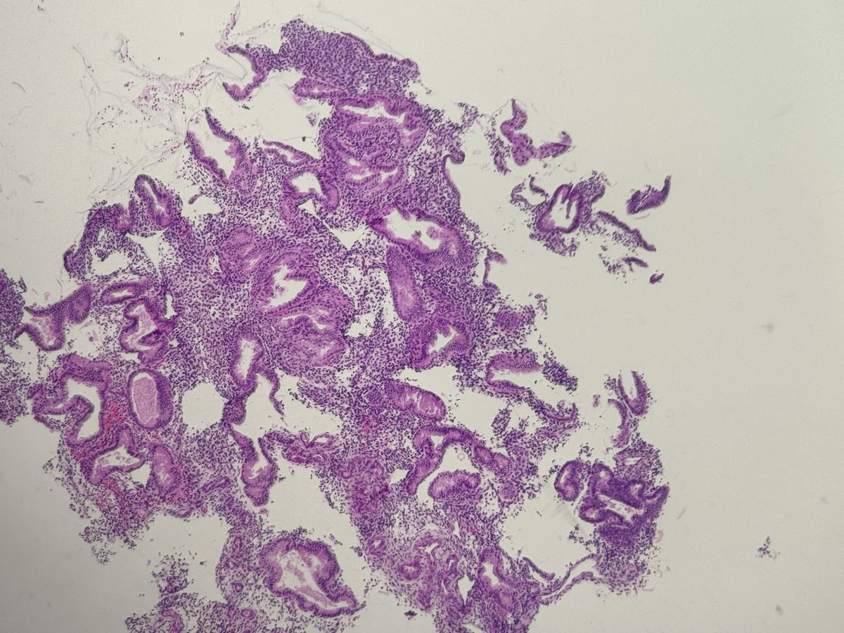 RMorrowPath's tweet photo. While I wait for IT to unlock my PC I thought I’d share how I take iPhone photos down my #pathology scope:
1. Tap the yellow flower (turns white with a line through it)
2. Follow the light to the histo and hold your finger on the histo (this will lock autofocus)
3. Zoom
4. Snap https://t.co/ATW4MMZXp5