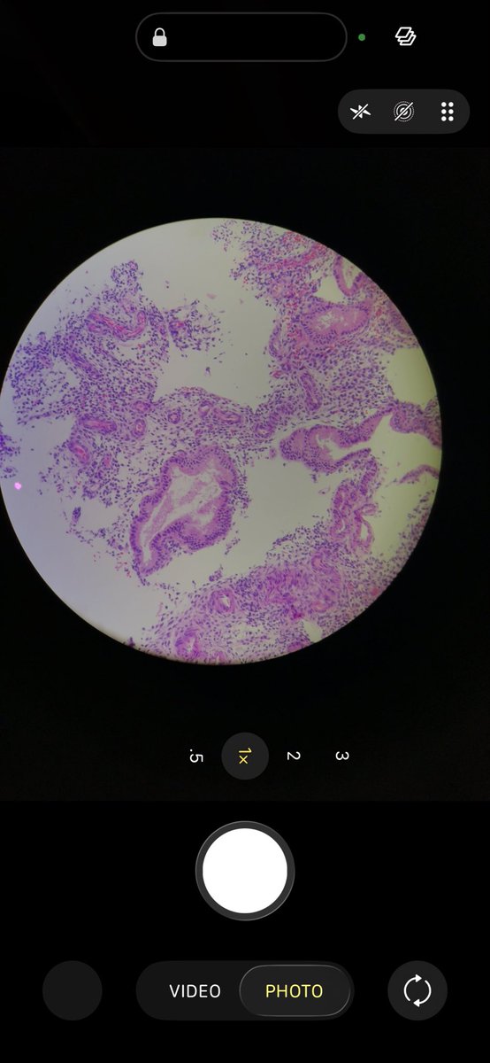 RMorrowPath's tweet photo. While I wait for IT to unlock my PC I thought I’d share how I take iPhone photos down my #pathology scope:
1. Tap the yellow flower (turns white with a line through it)
2. Follow the light to the histo and hold your finger on the histo (this will lock autofocus)
3. Zoom
4. Snap https://t.co/ATW4MMZXp5