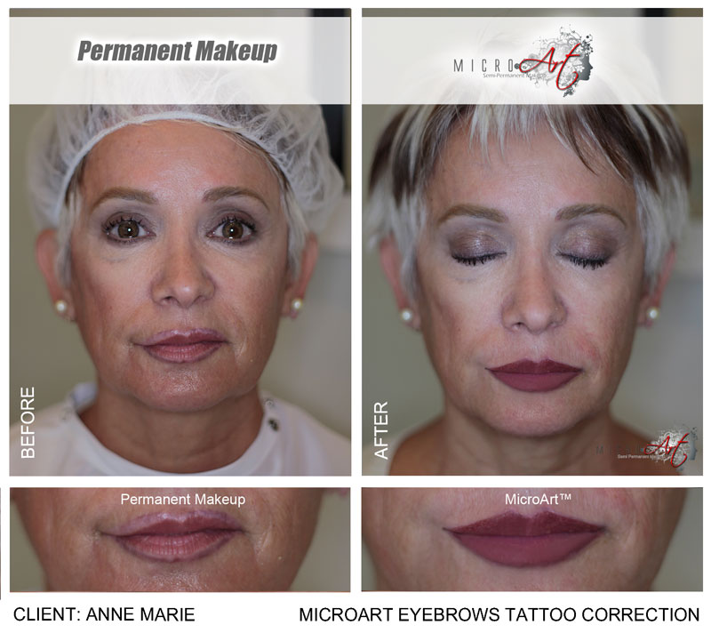 Micro_Art's tweet photo. About half of MicroArt's work is correcting permanent makeup and its side effects. We've corrected thousands of permanent makeup mishaps, making our clients very happy!

https://t.co/TAjAgdTOgQ https://t.co/Li84itkkBx