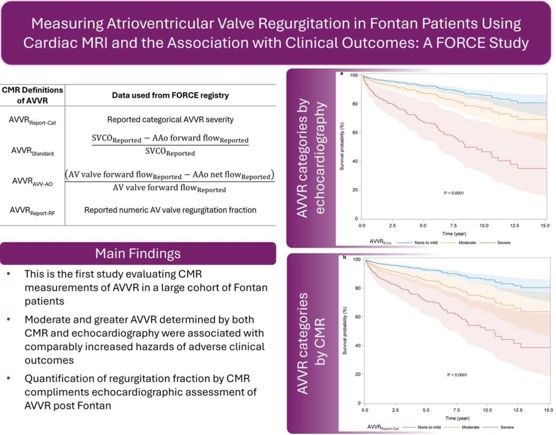 AlsaiedTarek's tweet photo. New @FORCEregistry  study @SCMRorg :
✅2,300 #Fontan , moderate/severe atrioventricular valve regurgitation—by CMR &amp; echo—strongly predicts death/transplant.
CMR (especially quantitative RF) adds powerful risk stratification and complements echo. 
👉10.1016/j.jocmr.2026.102748 https://t.co/StONtBiRuE