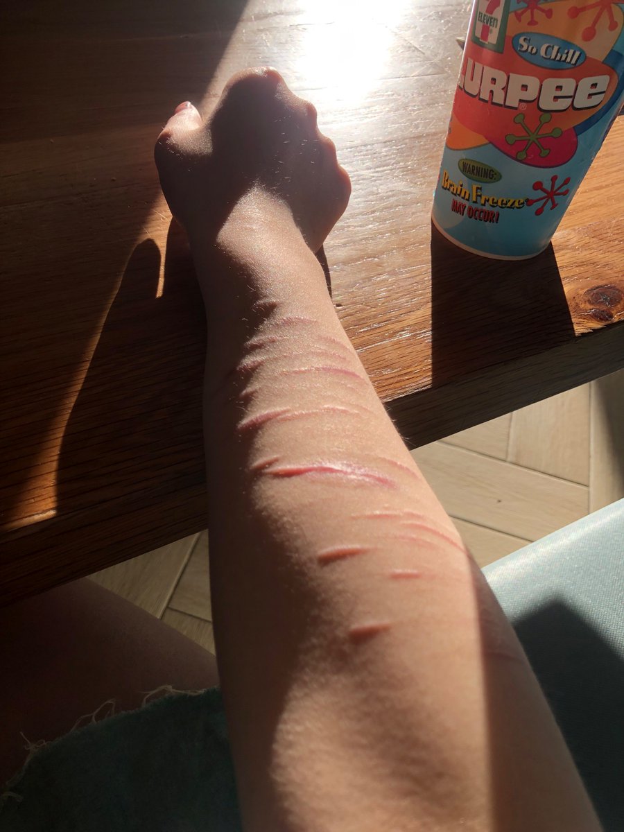 raincandyirl's tweet photo. ew. #shtwt https://t.co/oYFzoDNRuj