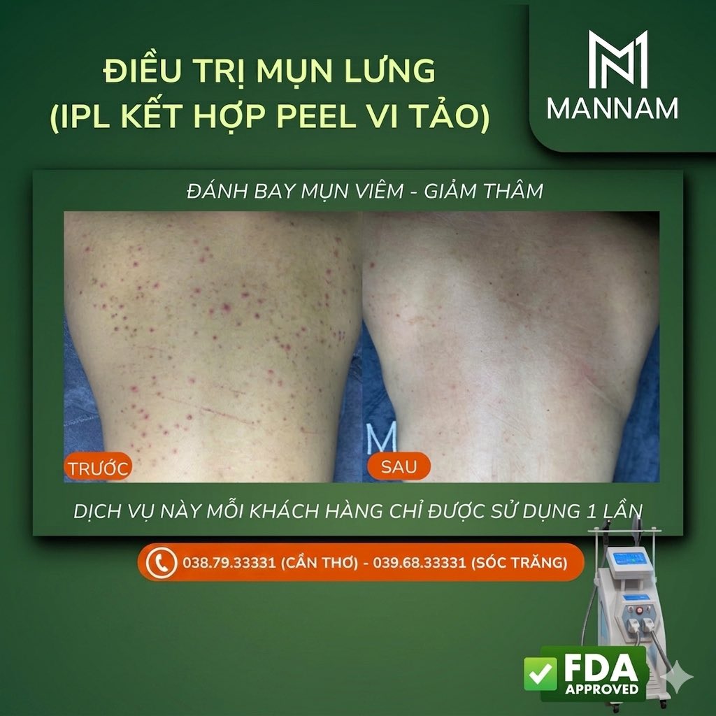 ManNam Spa For Men Cần Thơ tweet media