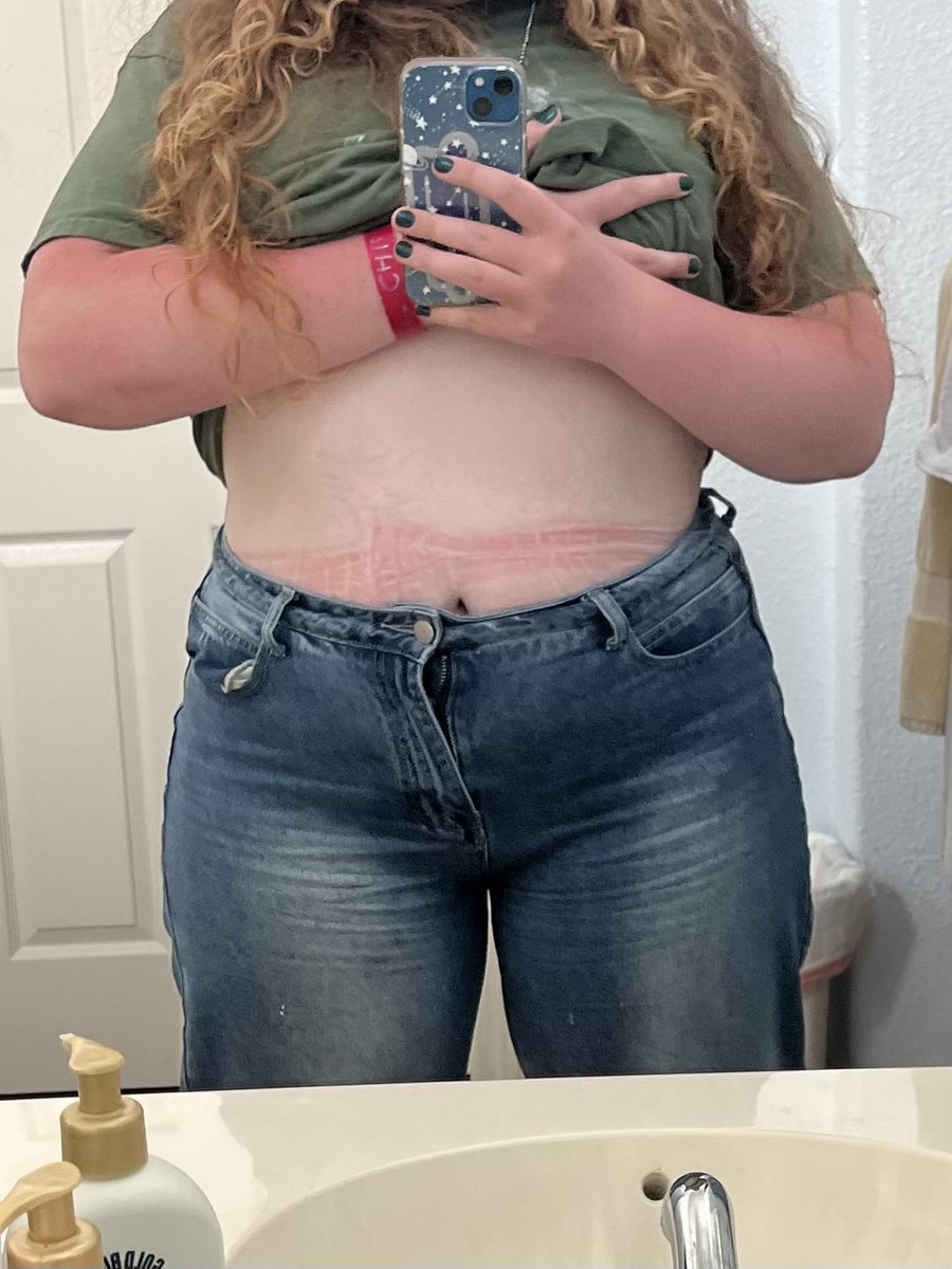 summer_child13's tweet photo. bc in my fav jeans! i know i'm very fat but i feel like i at least have potential, right? also ignore my sunburned arms and lines on my stomach https://t.co/cHorOnuPF7