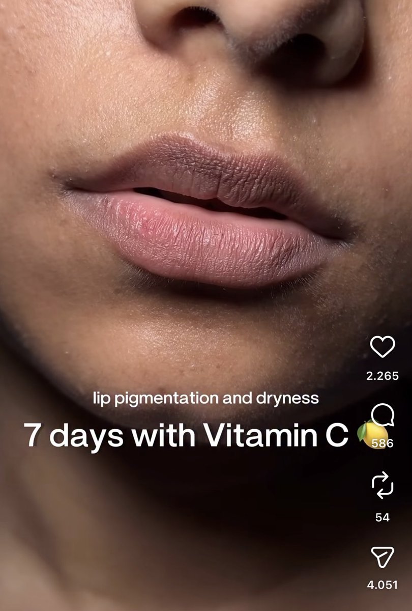resoulgallery's tweet photo. Siapa sangka brand korea udah masuk ada di toko oren indo🥹 ASLI (ORI) girlsss🫵🏻🫶
VITAMIN C BOOSTER SHOT
teksturnya Cream yahh🤏🏻🫶

Ada kandungan Glutathione juga 💯￼ https://t.co/k8xSPhTWoW