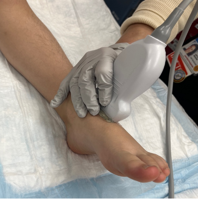 ALiEMteam's tweet photo. New PEM POCUS tutorial: Pediatric Musculoskeletal Ultrasound 🦴

Authors: Drs. Alyssa Goodman and Joni Rabiner
Series Editor: Dr. Margaret Lin-Martore

Read + take the 2-hour ALiEMU course: https://t.co/AYSEPiFj1s https://t.co/UxoKvbcCJU