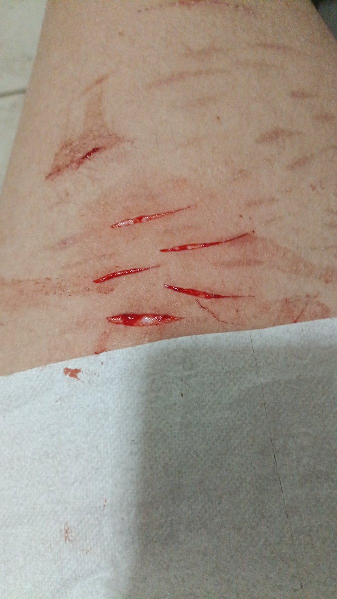 Aleesforme's tweet photo. repost because i got SNIPED, deep styros (i think) maybe baby beans?? so proud of these, snapping razors for the win!!! (do the sound they make when ripping the skin are AWFUL) #slittwt https://t.co/zFamEkPP1N