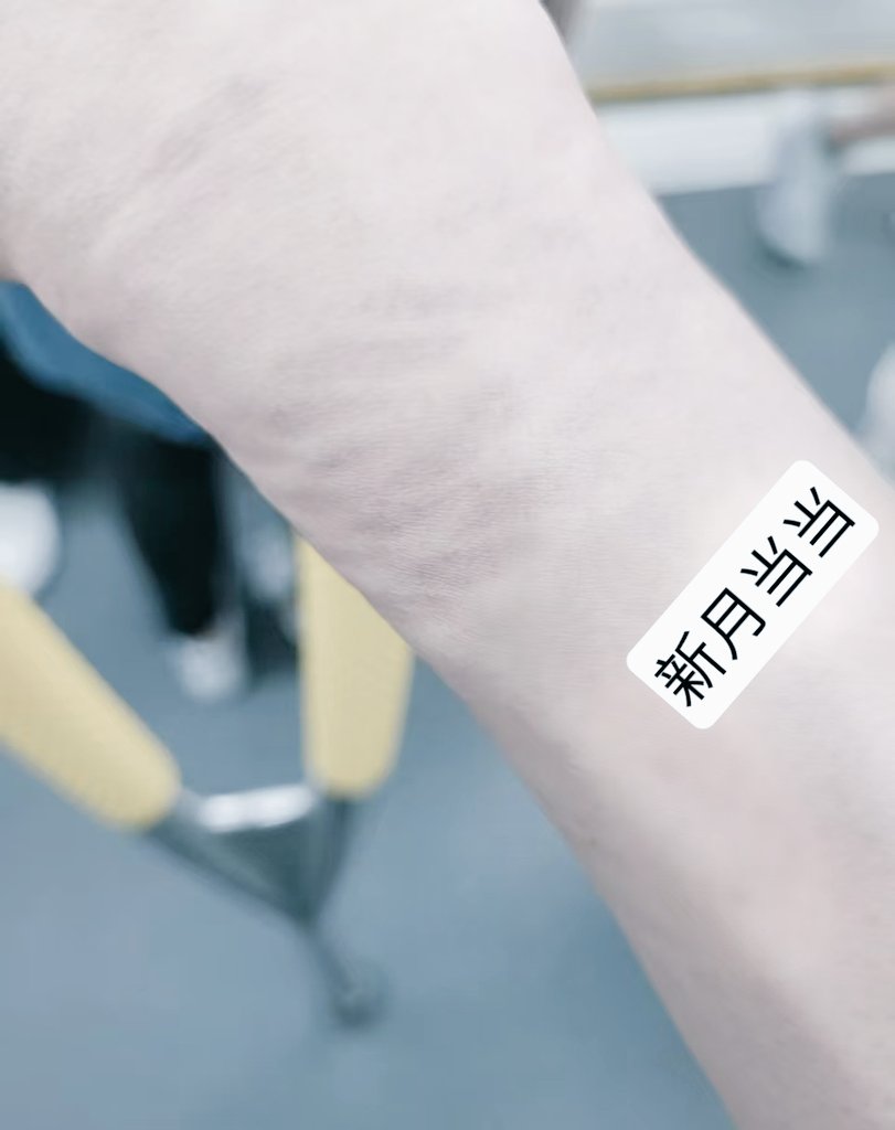 torn881's tweet photo. 羞耻。。从来不止于暴露。。
这种在公众场合，心怕被看穿被发现的感觉，更能紧紧的扎进新月內心深处。。。昨天调教过后，就伴随着绳痕走在路上🥺 https://t.co/6nOCD4nobH