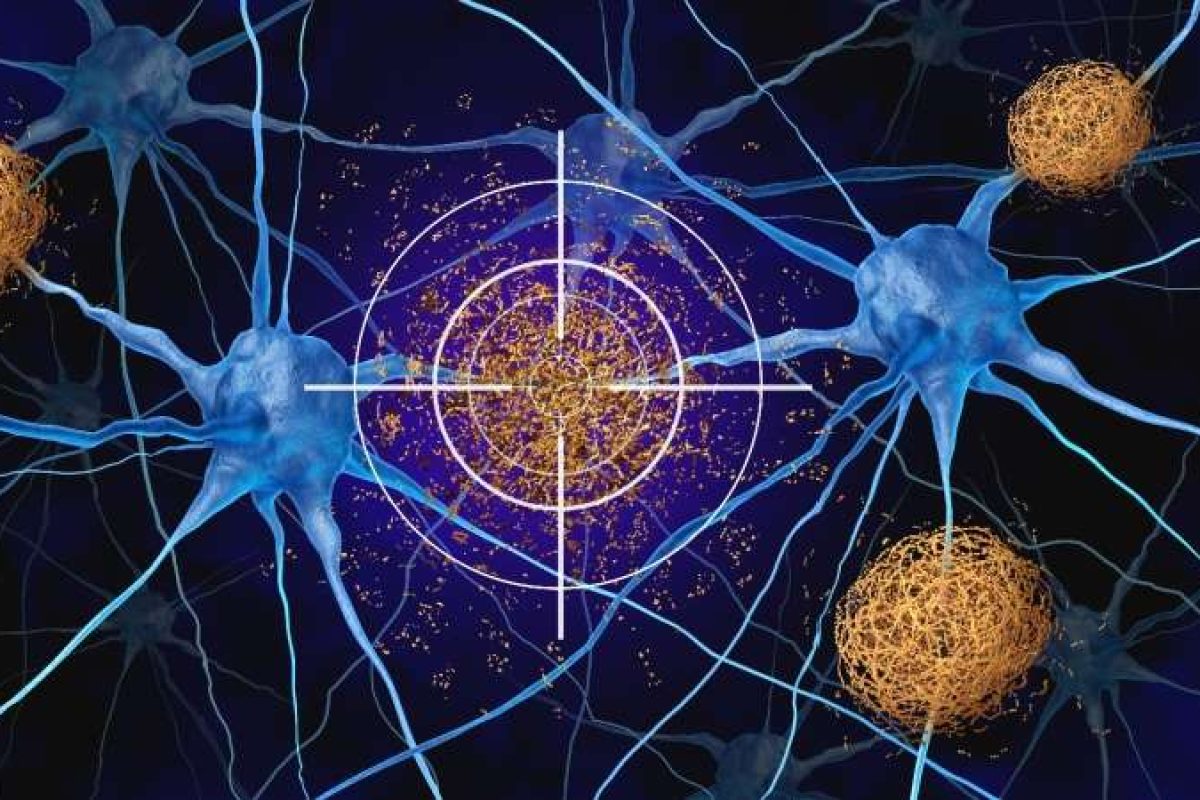DDWJournal's tweet photo. Refining, not abandoning, the amyloid hypothesis: Precision medicine after the Cochrane review

https://t.co/WrnjfmwbY5

Follow DDW; Business insights for the global scientific community
#MonoclonalAntibodies https://t.co/6oepP8h84F