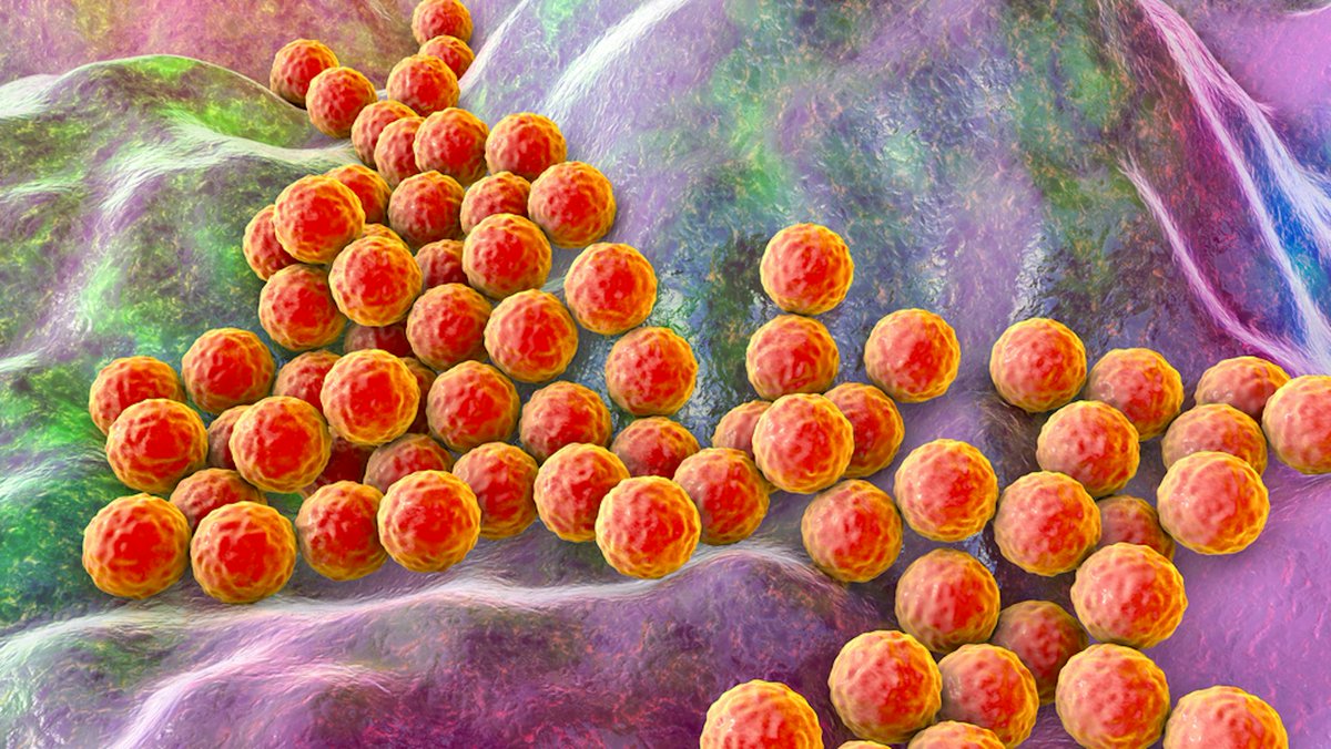 BiolegsCAT's tweet photo. Un nou estudi ha identificat un nou factor que influeix en la gravetat de les infeccions sanguínies causades per Staphylococcus aureus.
via  @Conversation_E 
🔗 https://t.co/aIgWhghE2L https://t.co/KCCo1LsdhT