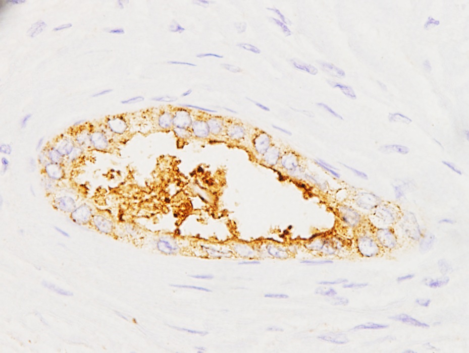 CSIC's tweet photo. 🔬Desarrollan un prototipo de test diagnóstico para detectar el #CáncerPáncreas

🩸Identifica un biomarcador asociado al cáncer en minutos con una muestra de sangre

🔎Tras el primer ensayo en pacientes, será optimizado antes de su aplicación clínica

➡️ https://t.co/HoD7VFdMti https://t.co/eJVhIgRZ10