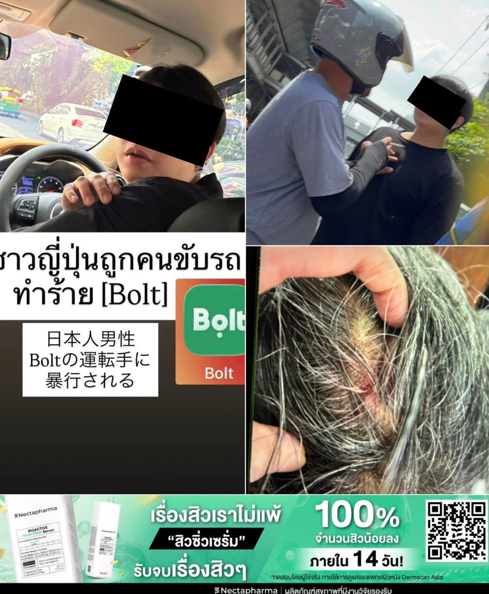 TK_cnd's tweet photo. 日本人さん、Boltタクシードライバーから暴行受けたらしい。
Bolt使うからや。 https://t.co/8QvrF3JCrL