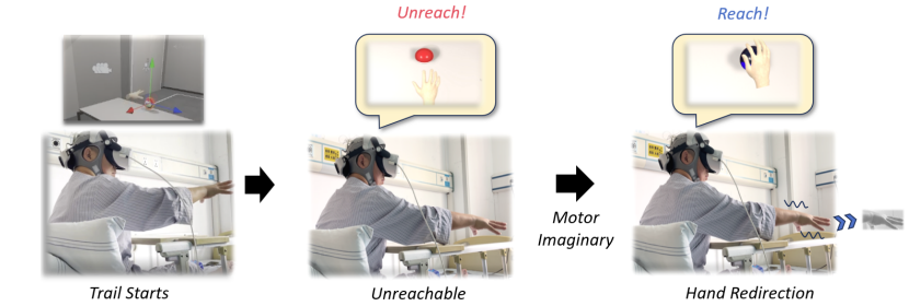 Neuroelectrics's tweet photo. What if VR rehab could detect real engagement🧠

Using EEG-based motor imagery signals, researchers amplified virtual hand movement only when patients were actively engaged, improving performance in stroke rehabilitation.

Paper: https://t.co/7P1dwfiKBS

#StrokeRehabilitation https://t.co/yp0I2jMa9K