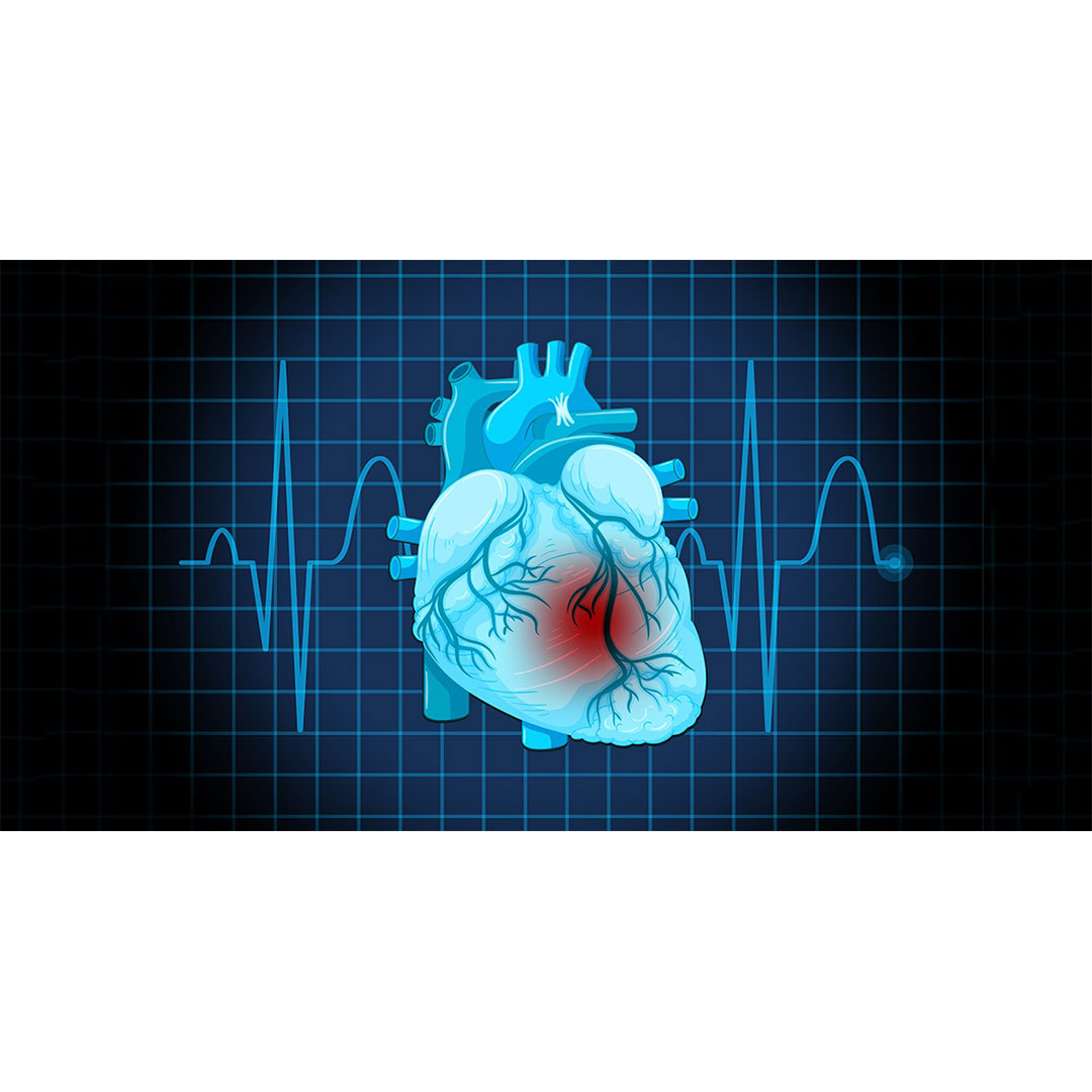 CVIA_Journal's tweet photo. This #CVIA study emphasizes early #PalliativeCare integration in advanced #HeartFailure, improving symptoms, enhancing quality of life, and strengthening shared decision‑making, while reducing hospitalizations and supporting caregivers. @UFMedicine 
#OpenAccess:https://t.co/K98GesdRMb
