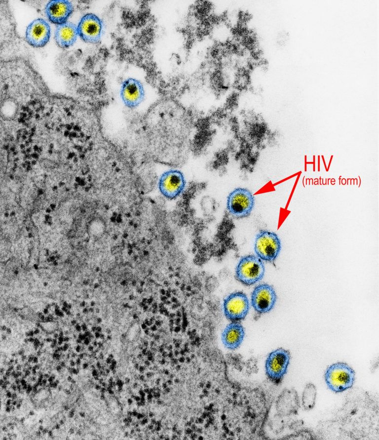 latestincosmos's tweet photo. 🚨: An Experimental HIV vaccine successfully triggered right immune response in 47 of 48 people breaking a 40 years barrier. https://t.co/juRlZhYCmL