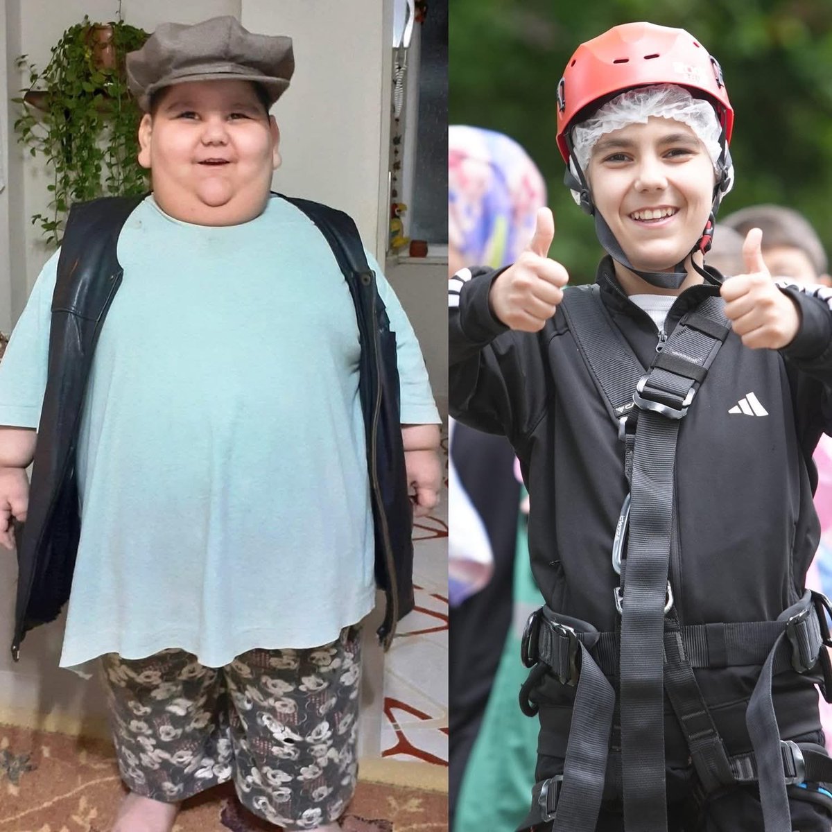 goodoctorss's tweet photo. Samsun’da doğuştan leptin hormonu eksikliği nedeniyle tokluk hissi oluşmayan ve 5 yaşında 90 kiloya ulaşan Yağız Bekte, tedavi sayesinde 11 yaşında 40 kiloya düştü. https://t.co/RG8x53Dimg