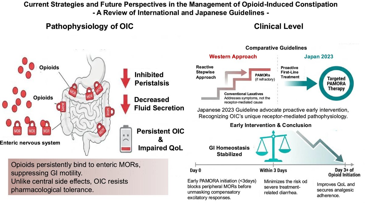 NGMJournal's tweet photo. 🆕🔥Current Strategies &amp; Future Perspectives in Management of #Opioid-Induced #Constipation: Review of International &amp; Japanese Guidelines‼️
⏬Dive into to learn more about most recent advances #mechanism-based early intervention💡
👉 https://t.co/m95GStpZEt
@ANMSociety @esnm_eu https://t.co/aNTpw6mme5