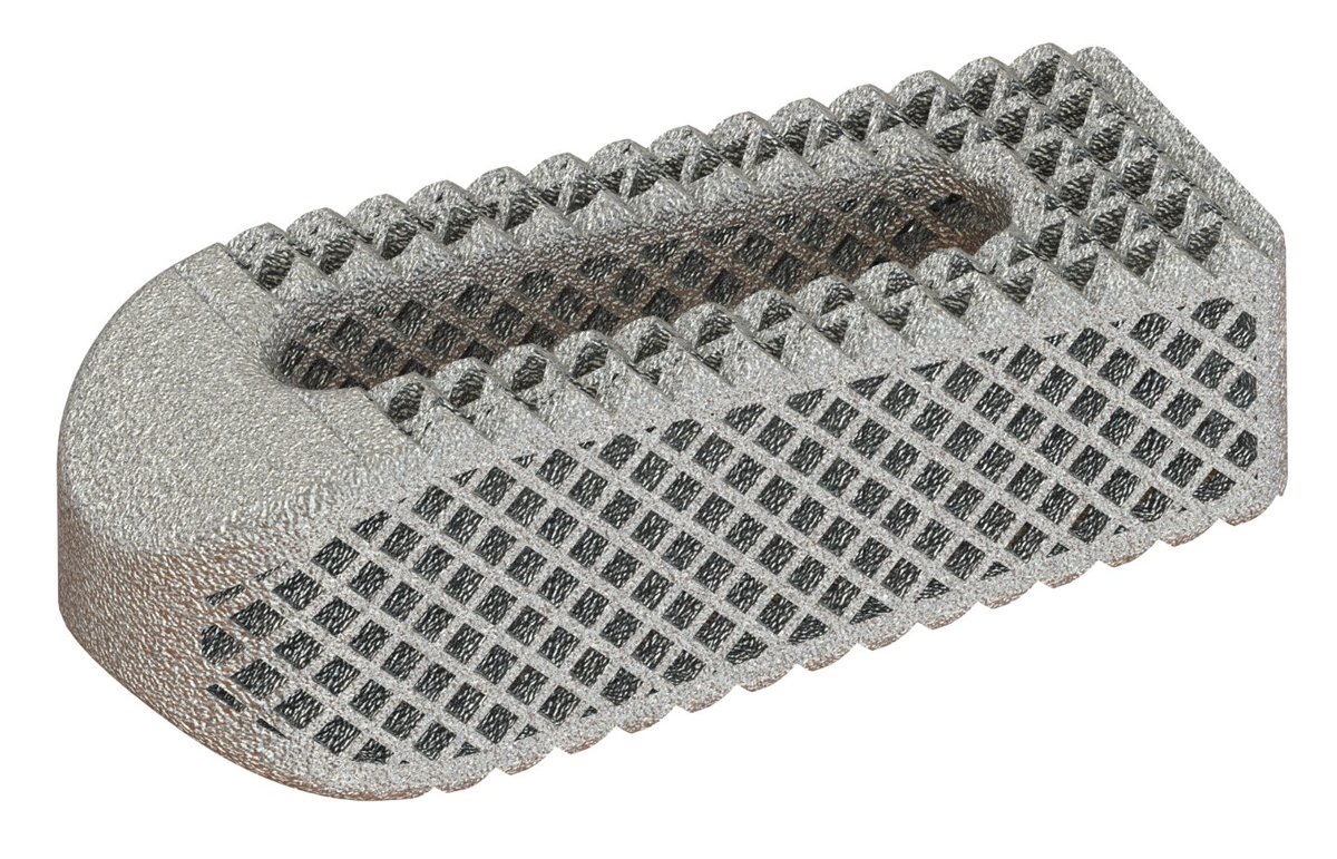 OsseusFS's tweet photo. The 80% implant porosity of the Aries-TS TLIF Interbody provides optimal biomechanical performance and graft packability.

To schedule a product demo, reach out to sales@osseus.com

To learn more, please visit https://t.co/QJkKu2vPFm https://t.co/GgnpxJlWwu