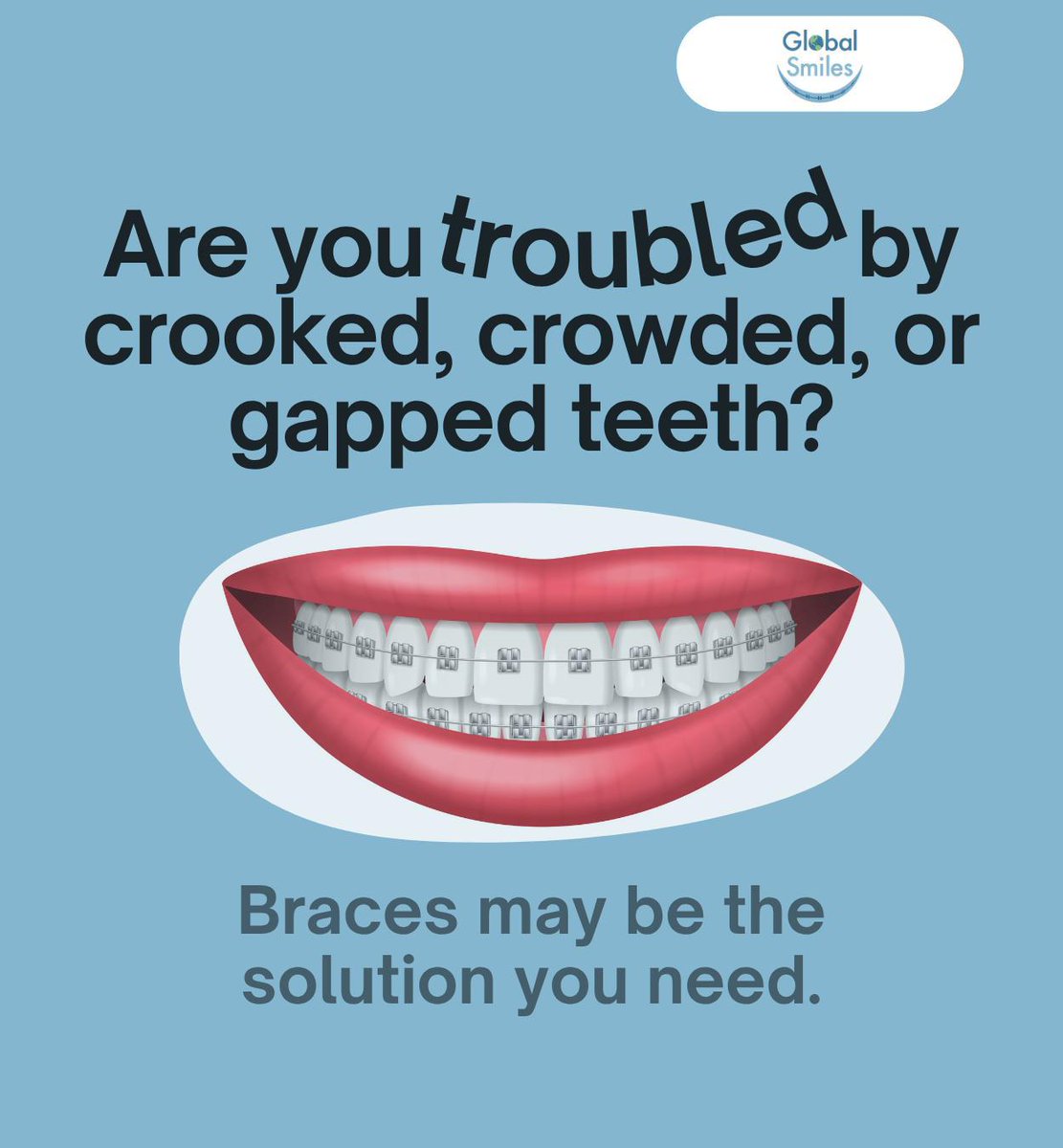GlobalSmiles1's tweet photo. Braces align your smile, help you maintain better oral hygiene, improve oral health, and increase confidence. Take the step toward healthier, happier smiles and lifelong benefits.
.
.
.
https://t.co/qtHgzYkHQe
(614) 230-0374
.
.
.
#braces #straightteeth #orthodontics #Columbus https://t.co/yFgkHXHfYc