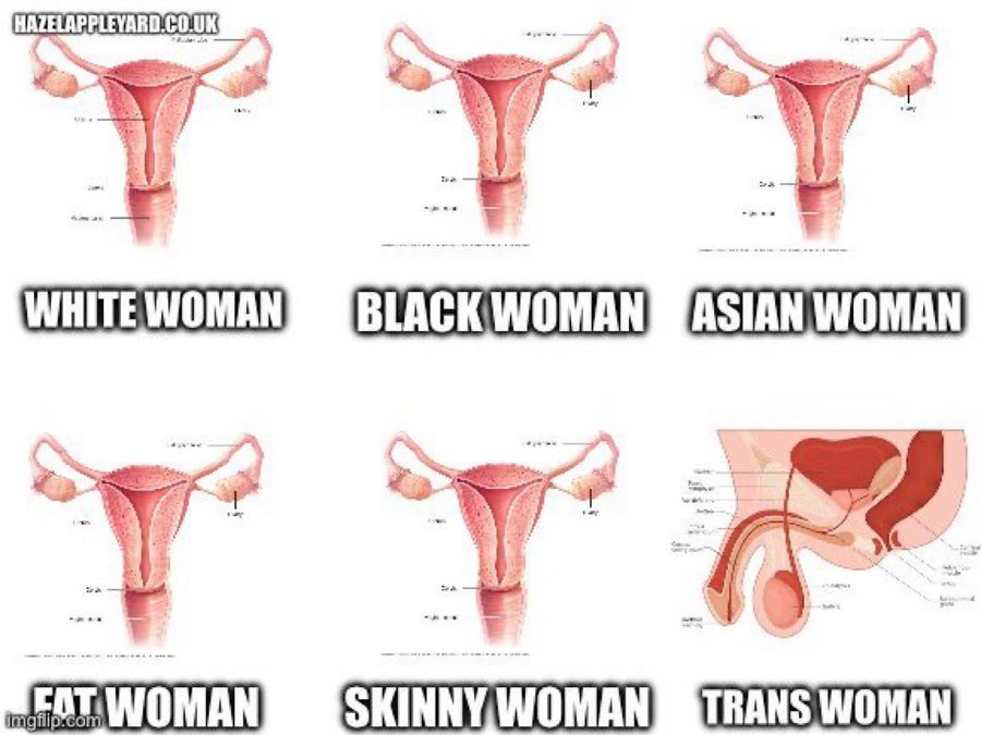 BaronBurleigh2's tweet photo. Thanks Bob passing it on @bobmccoskrienz 
Biology lesson for ALP woman. https://t.co/YXaq8UZ5Kn