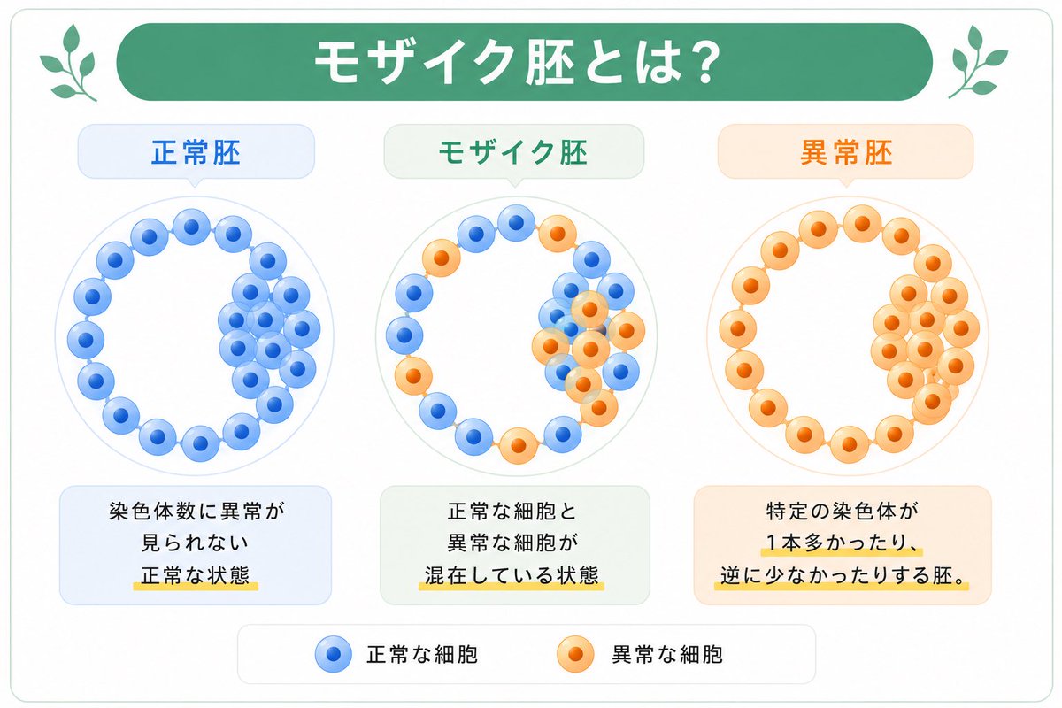 dashin_jp's tweet photo. ⁡こんにちは、大新生殖医療センターです🕊️

PGT-Aの検査結果で「モザイク胚」と判定されると、
驚きや不安を感じる方も少なくありません。

しかし、モザイク胚は
「完全な異常胚」という意味ではありません。

🔍 モザイク胚とは？
モザイク胚とは、正常な細胞と染色体異常をもつ細胞が
混在している可能性がある胚のことを指します。

⁡🧬PGT-A結果の見方について
PGT-Aの結果では、主に「Results（CNV Interpretation）」の欄にて、胚の染色体数の状態をご確認いただけます。

🔹 Euploidy（正常）
→ 正常染色体数に大きな異常が見られなかった状態

♦️ Aneuploidy（異数性）
→ 特定の染色体が1本多い、または少ない状態

🔸 Mosaicism（モザイク）
→ 正常な細胞と異常な細胞が混在している可能性がある状態

☑️ なぜモザイクの判断が難しいのか？
PGT-Aで検査しているのは、
胚盤胞の「栄養外胚葉」と呼ばれる部分です。

この部分は将来胎盤になる細胞群であり、赤ちゃんになる内部細胞塊そのものを直接検査しているわけではありません。
そのため、検査した部分には異常細胞が含まれていても、胚全体では異なる状態の可能性もあります。

移植の可否については、

✔ 胚のグレード
✔ 胚の形状
✔ 染色体異常の内容
✔ 胚の発育状況

などを総合的に確認しながら判断していきます。

PGT-A検査結果だけで判断するのではなく、胚の状態やこれまでの治療経過も含めながら、総合的に考えていくことが大切です🌿
⁡
詳しくは当院ブログをご覧ください📖✨
⁡
⁡当院では、日本語でのオンラインカウンセリングも行っておりますので、ご不安なことや気になる点がございましたら、いつでもお気軽にご相談ください💁🏻‍♀️

▼PGT-Aで「モザイク胚」と判定されたら
https://t.co/uB56ohLi7Q

#卵子提供 
#PGTA
#着床前診断
#モザイク胚
#不妊治療