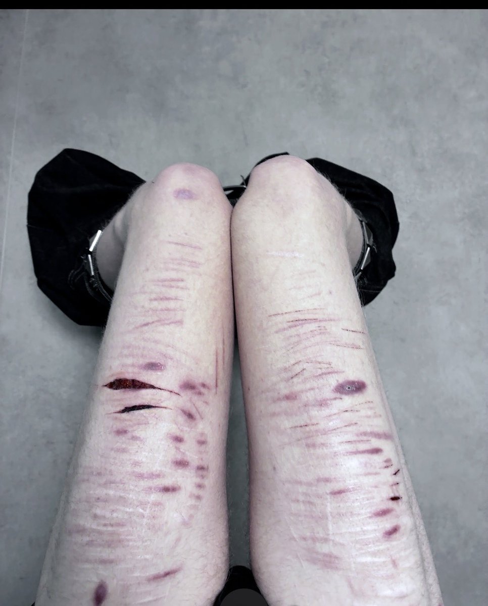 Cutkinklvr's tweet photo. thigh check 
#shtwt #sh https://t.co/qBxeINo32Q