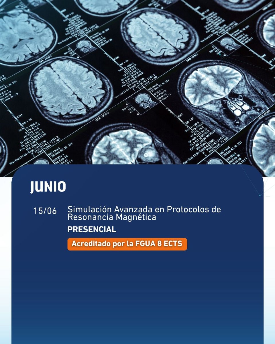 ibquaes's tweet photo. JUNIO · IBQUAES

🧲 Simulación Avanzada en RM
Planificación y parámetros en entorno real

📅 15/06 – 03/07
👉 https://t.co/qm2eiTxZeL

#ResonanciaMagnética #IBQUAES https://t.co/ujfk3HYkph