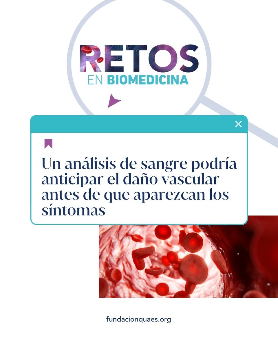 FQuaes's tweet photo. Las enfermedades cardiovasculares suelen empezar mucho antes de dar síntomas ❤️

Un estudio sugiere que el glicocálix de los glóbulos rojos podría reflejar el estado de los vasos sanguíneos y ayudar a detectar daño vascular de forma más sencilla.

Más en #RetosEnBiomedicina

#JuntosCompartiendo