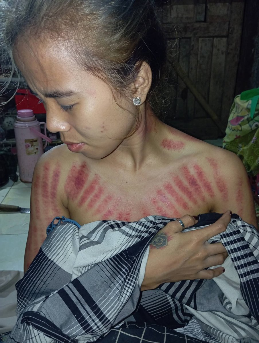 YohanesS27722's tweet photo. Main kerumah teman SMA malah disuruh ngeroki hasilnya merah gosong https://t.co/wBWKbK6sgL