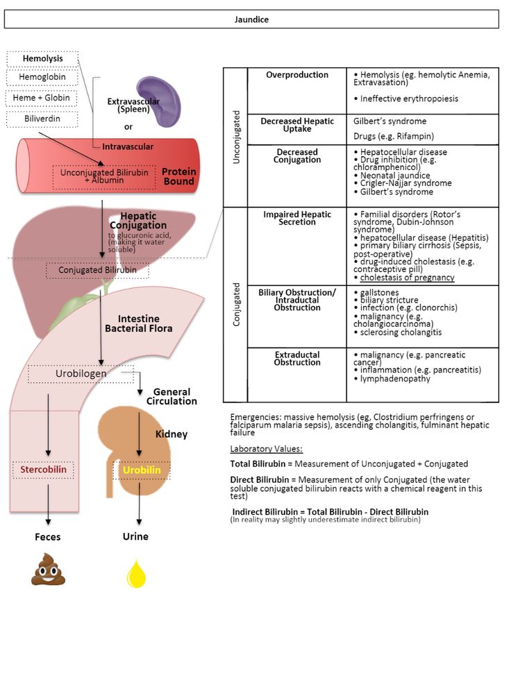 drsthanus's tweet photo. Jaundice - Pathophysiology and Causes...

@AmyChung https://t.co/V4AWpzGGXO